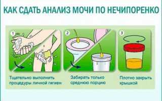 Анализ мочи по Нечипоренко — расшифровка анализа, таблица показателей