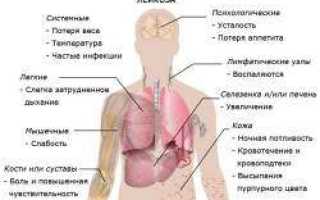Фосфомицин при цистите