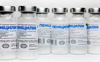 Что означает белок в моче у мужчин: норма, от чего повышается, как понизить