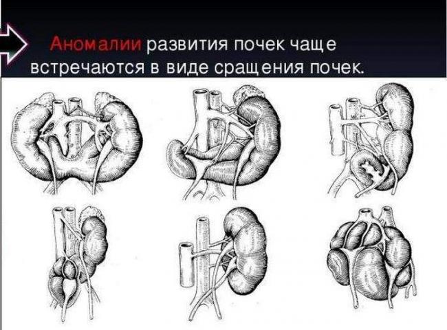 1-159-700x517.jpg