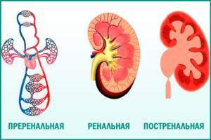 Simptomy-pochechnoj-nedostatochnosti-300x200.jpg