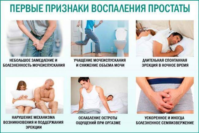 Pervye-priznaki-vospalenija-prostaty.jpg