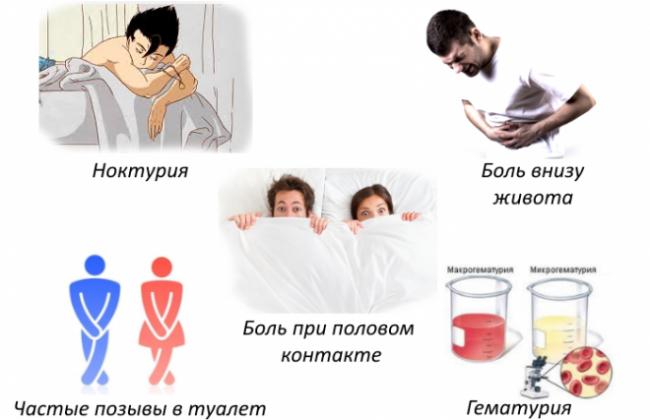 Simptomy-tsistita-e1490602001282.png
