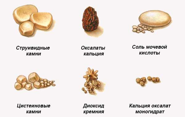 kamni-v-pochkah.jpg