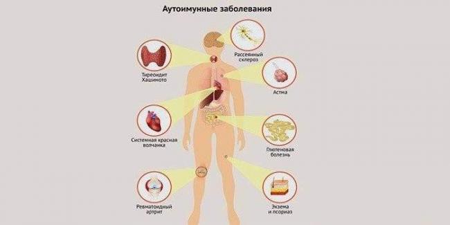 8910013-1simptomyi-autoimmunnyih-bolezney.jpg