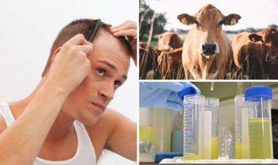 Urine_for_hair_growth_1-550x326.jpg