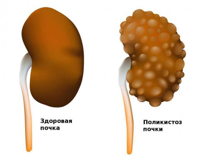 4Belokvmochechtoetoznachit.jpg
