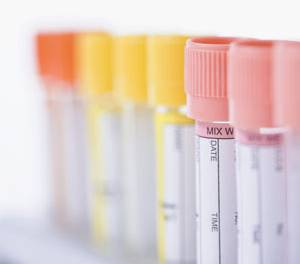 Test_vials.jpg