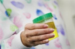 201742-2145x1397-Urine-specimen-300x195.jpg