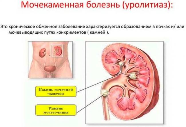 opuschenie-pochek-simptomy-i-lechenie-10.jpg