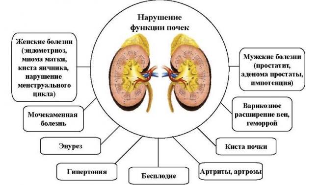 pochki-simptomy-zhenshhin-7.jpg