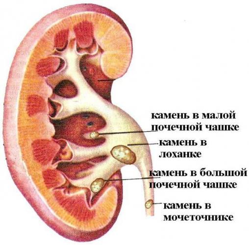 pochka-pravoj-storony-7.jpg