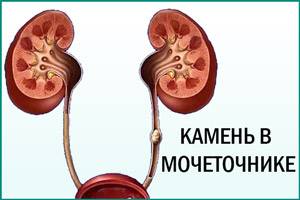 krov-pri-mocheispuskanii-u-zhenshchin-s-bolyu_2.jpg