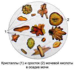 1-62-300x294.jpg