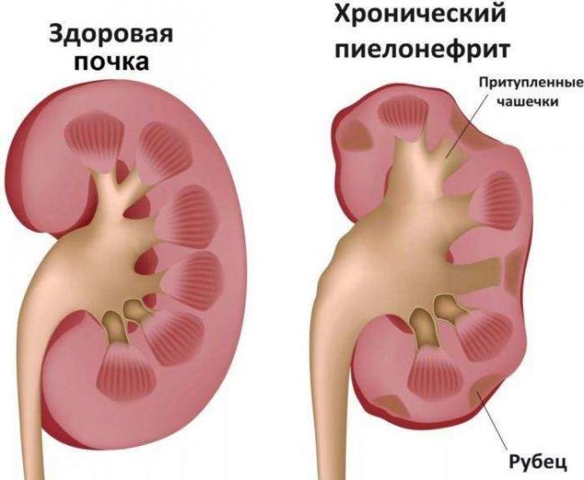 2-106-700x576.jpg