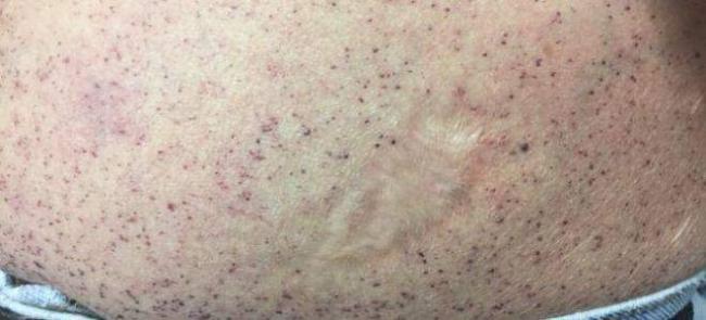 c2a5bd339_660x300.jpg