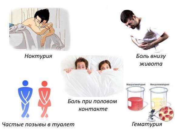 cistit.jpg
