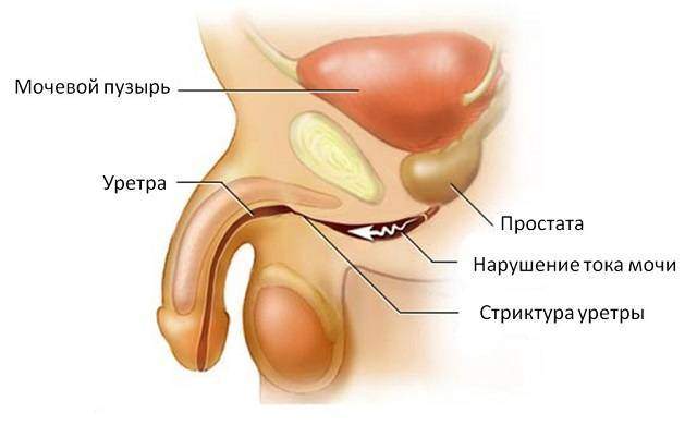 Uretrit-u-muzhchin-chto-eto.jpg