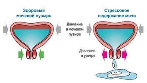 nederzhanimochi.jpg